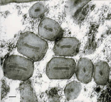 Einschlu�k�rper des Cydia pomonella Grranulovirus